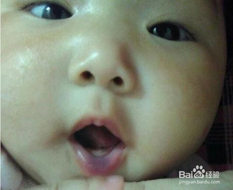 宝宝吃哈密瓜嘴唇黑紫了,宝宝吃哈密瓜嘴唇变黑紫的神秘现象揭秘